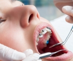 Записаться к ортодонту Минск на сайте dentalica.by